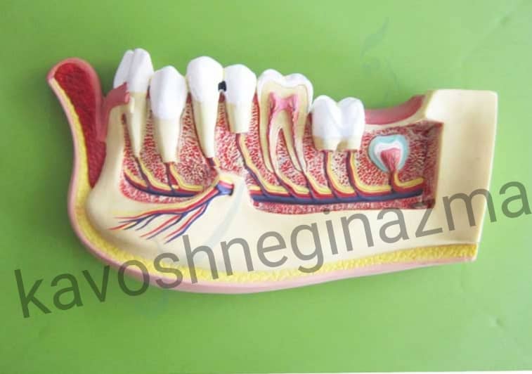 مولاژ نیم فک دندان دیواری 5 برابر اندازه طبیعی